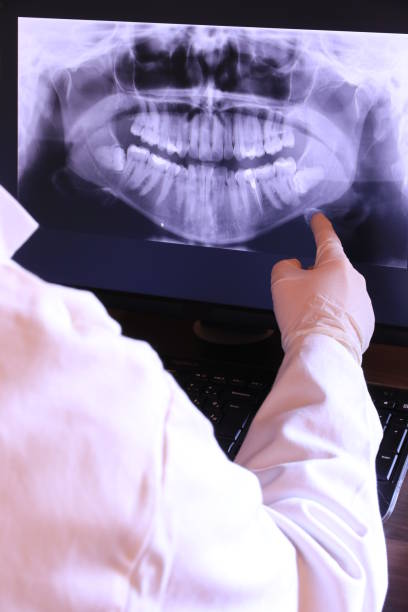 Best Emergency Treatment for Dental Infections or Abscesses in Long Branch, NJ