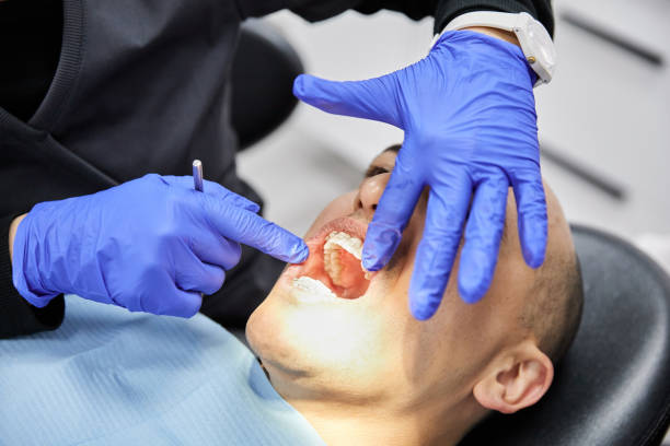 Best Emergency Treatment for Dental Infections or Abscesses in Long Branch, NJ