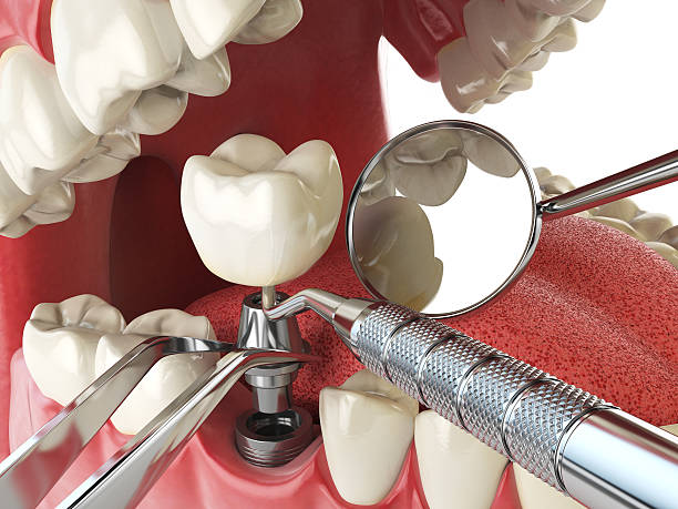 Best Urgent Care for Lost Fillings or Crowns in Long Branch, NJ